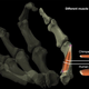 Image showing the difference between human and chimpanzee thumb muscles.